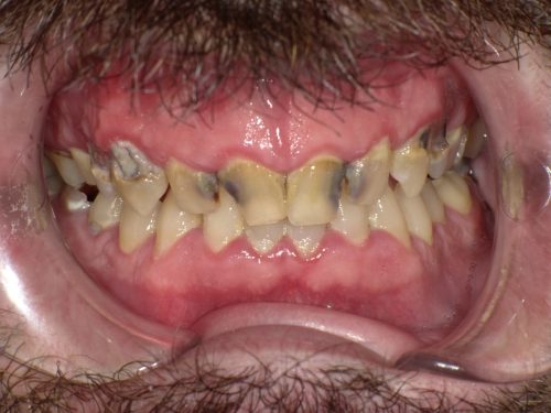 SHOFU DENTAL DIGITAL CAMERA