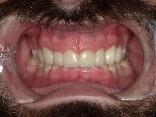 SHOFU DENTAL DIGITAL CAMERA